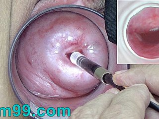 Nội soi Máy ảnh Nhật Bản bên trong cổ tử cung Cam vào âm đạo