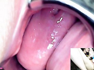 Adalynnx - Máy rung động cơ nội soi Hitachi Cum